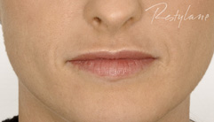 lips - after